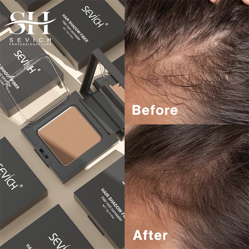 SEVICH 12g Hairline Powder Wit - Rooting Hormone Powder avis et prix